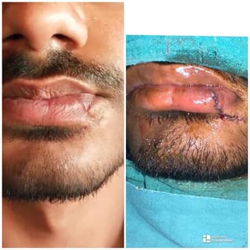 Slider image (3) Konarc Aesthetics - Plastic & Cosmetic Surgery In Gurgaon, India.